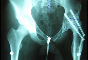 challenging-surgical-img